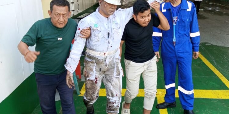 Kapal Aceh Hebat Meledak, 14 Orang Alami Luka Bakar